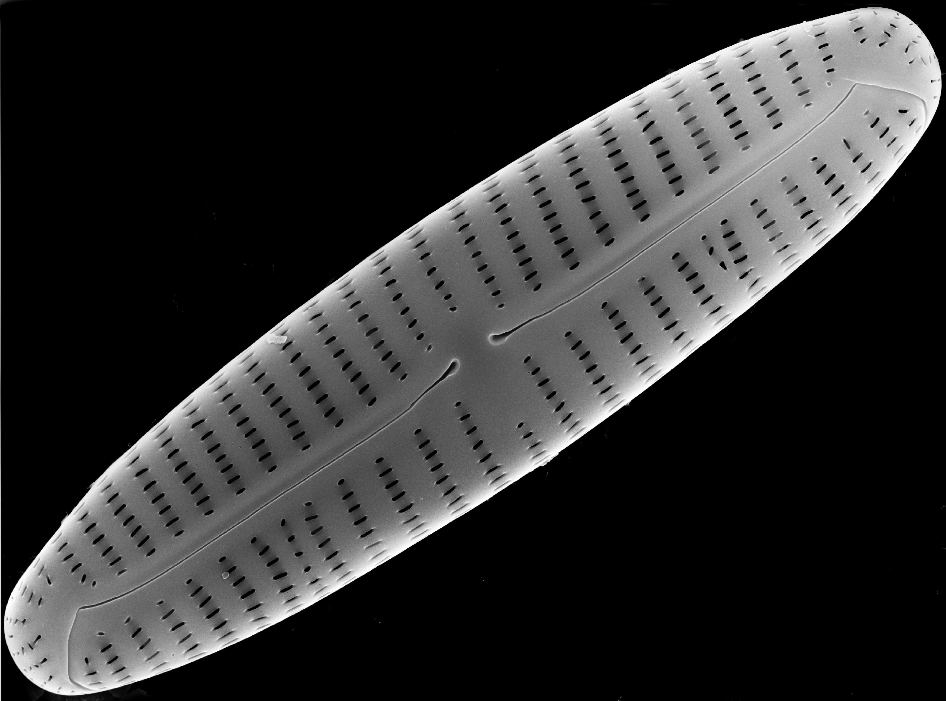 A microscopic image of an oval shaped diatom.