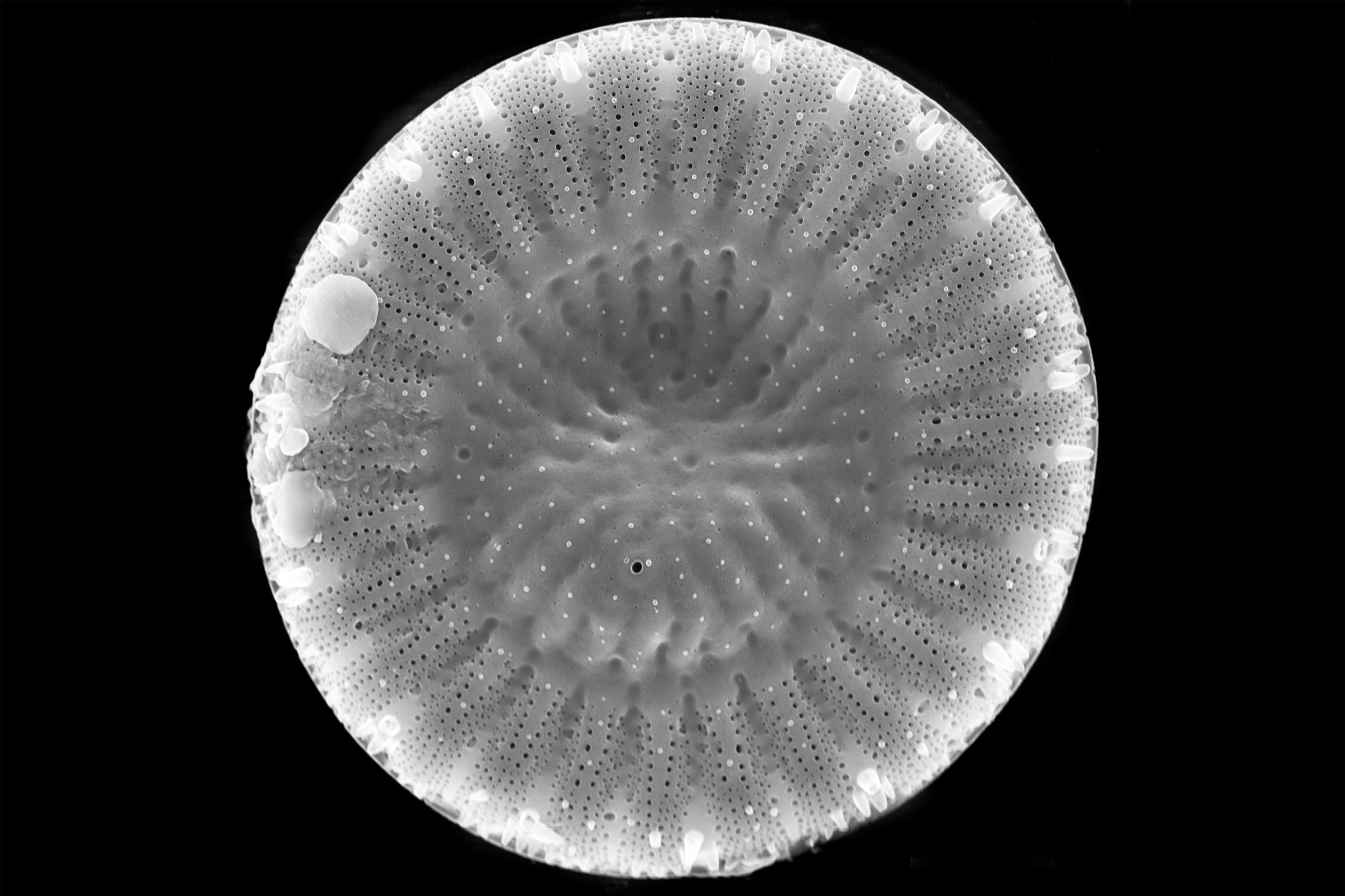 A close up of a diatom.
