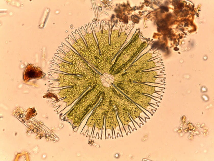 Micrasterias were among the algae found in Brooktrout Lake signifying the beginning of the recovery of the food web. Photo by Frank Acker/ANS