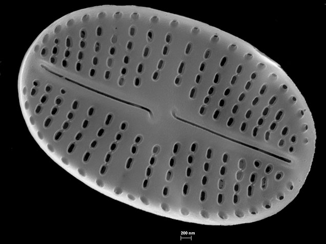 microscopic photo of a diatom a grey circular molecule surrounded by black background