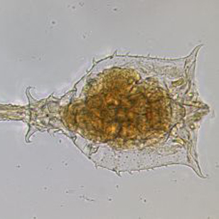 Trichotria truncata: Female, dorsal view, body