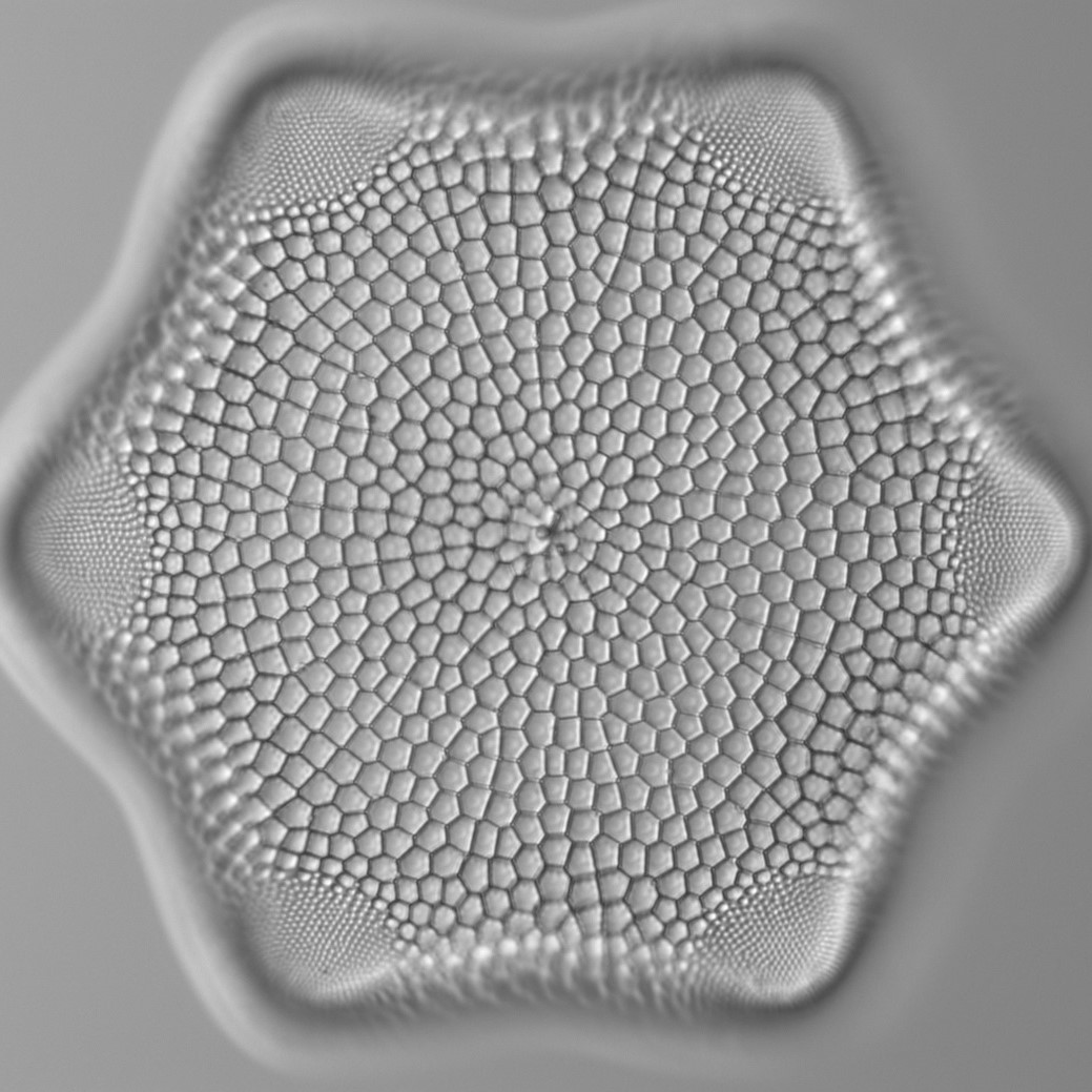 diatoms