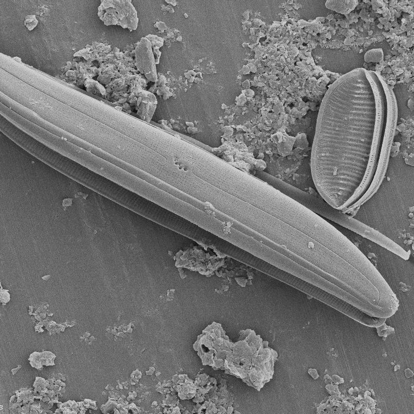 diatoms