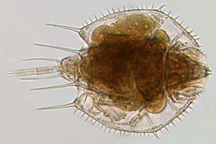 micrograph of the rotifer Macrochaetus